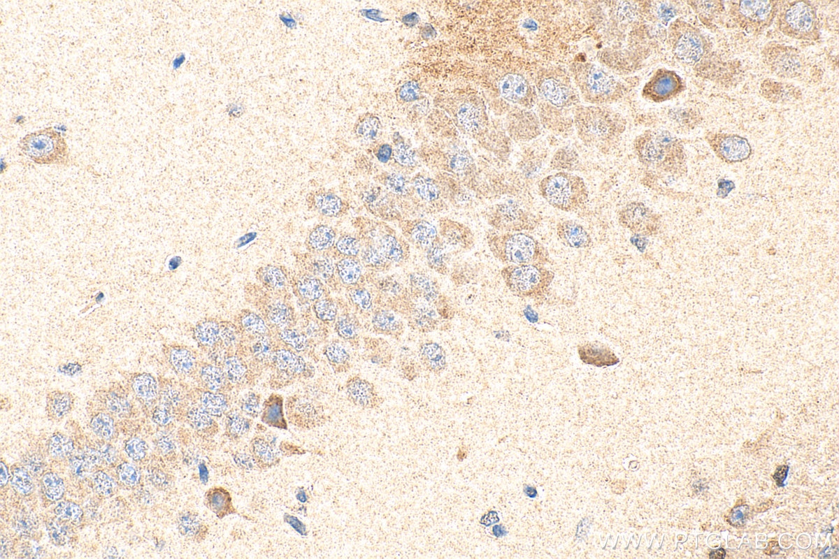 Immunohistochemistry (IHC) staining of mouse brain tissue using SERPINB2 Polyclonal antibody (16035-1-AP)