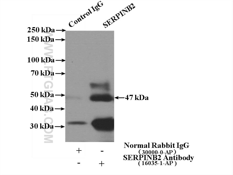 Immunoprecipitation (IP) experiment of Jurkat cells using SERPINB2 Polyclonal antibody (16035-1-AP)
