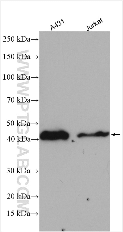 Western Blot (WB) analysis of various lysates using SERPINB2 Polyclonal antibody (16035-1-AP)