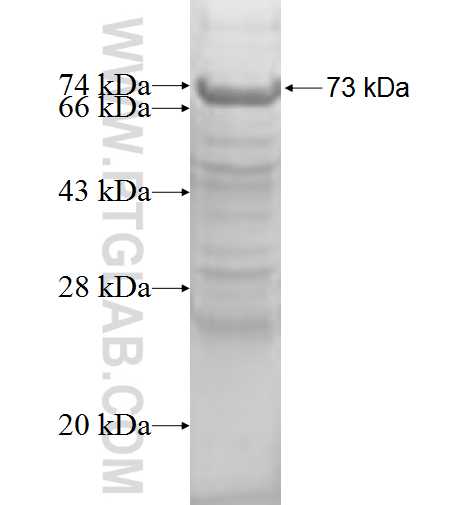 SERPINB2 fusion protein Ag8906 SDS-PAGE