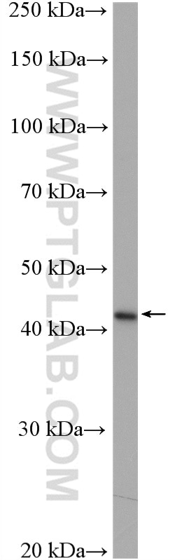 Western Blot (WB) analysis of human saliva using SERPINB3/4 Polyclonal antibody (26558-1-AP)