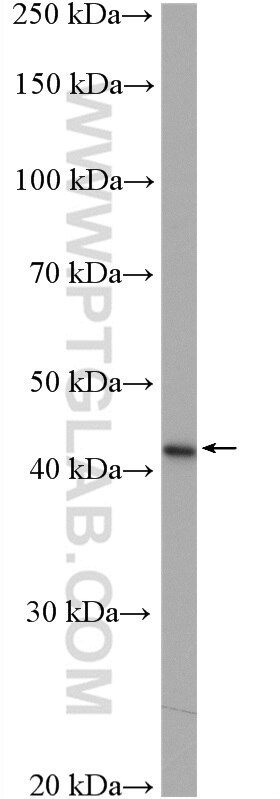 Western Blot (WB) analysis of human saliva using SERPINB3/4 Polyclonal antibody (26558-1-AP)