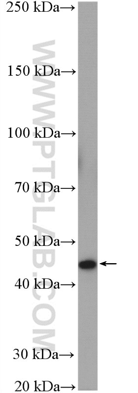 SERPINB3/4