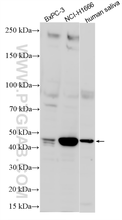 WB analysis using 26558-1-AP Western Blot (WB) analysis of various lysates using Serpin B3/4 Polyclonal antibody (26558-1-AP)