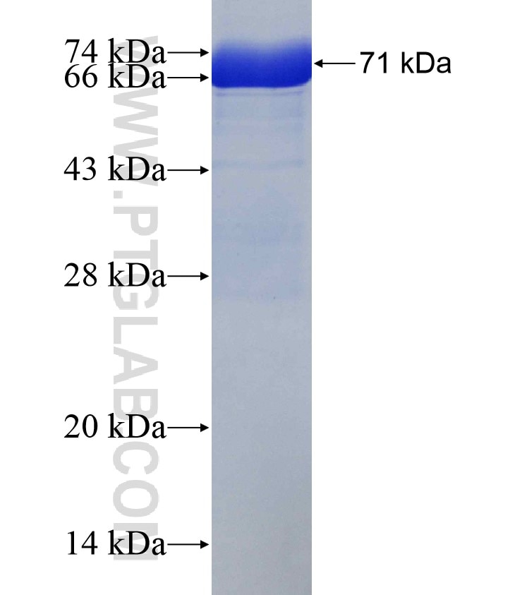 SERPINB3 fusion protein Ag8669 SDS-PAGE