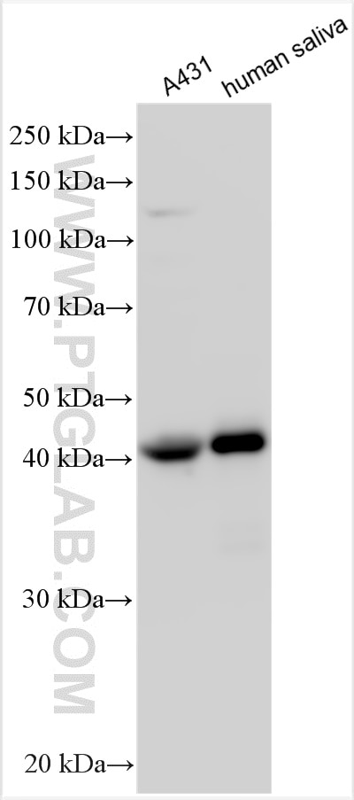 Western Blot (WB) analysis of various lysates using SerpinB3/SerpinB4 Polyclonal antibody (11428-1-AP)