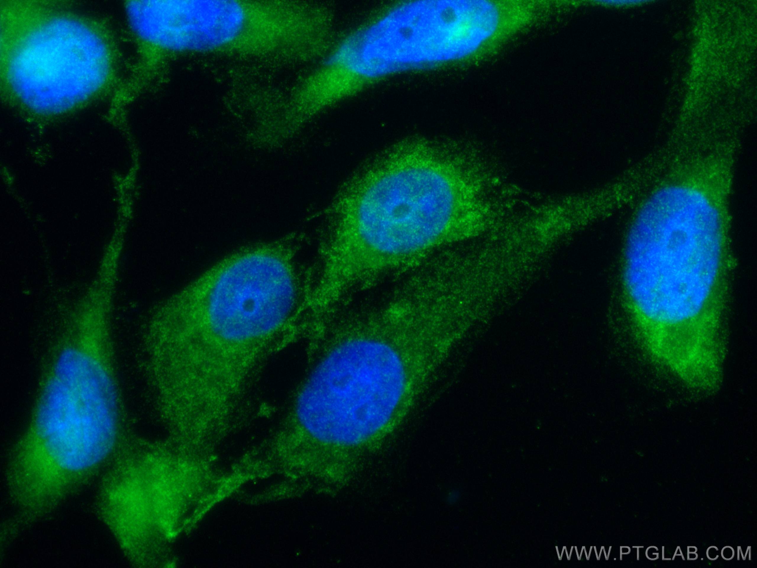 Immunofluorescence (IF) / fluorescent staining of A431 cells using Maspin Polyclonal antibody (11722-1-AP)
