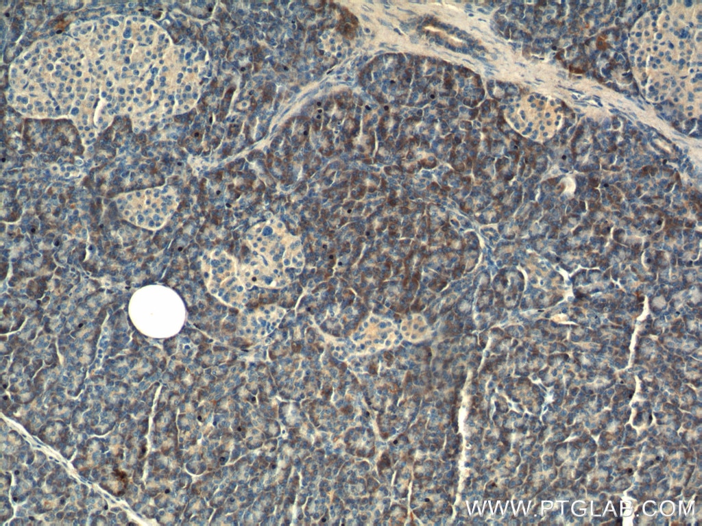 Immunohistochemistry (IHC) staining of human pancreas tissue using Maspin Polyclonal antibody (11722-1-AP)