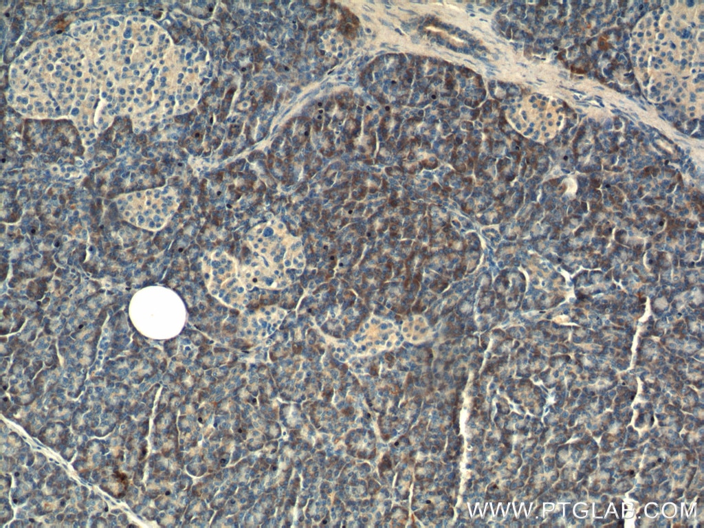 IHC staining of human pancreas using 11722-1-AP