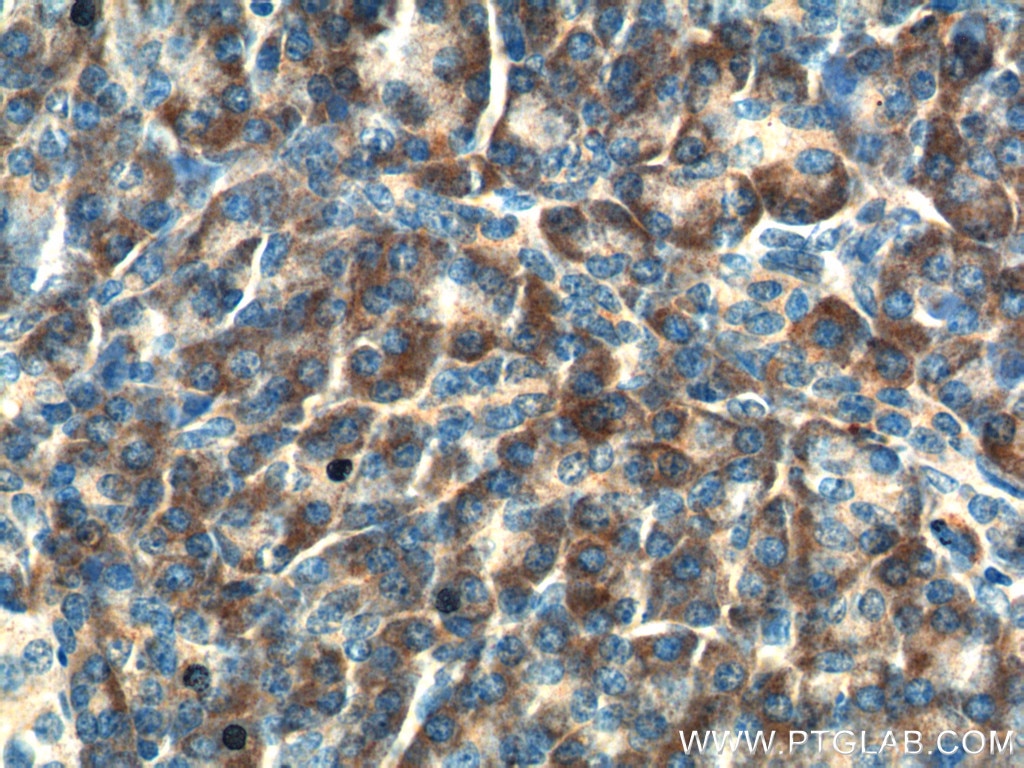 Immunohistochemistry (IHC) staining of human pancreas tissue using Maspin Polyclonal antibody (11722-1-AP)