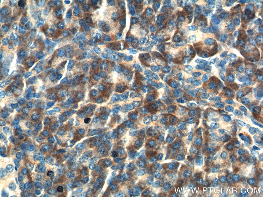 IHC staining of human pancreas using 11722-1-AP