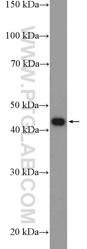 WB analysis of HeLa using 11722-1-AP