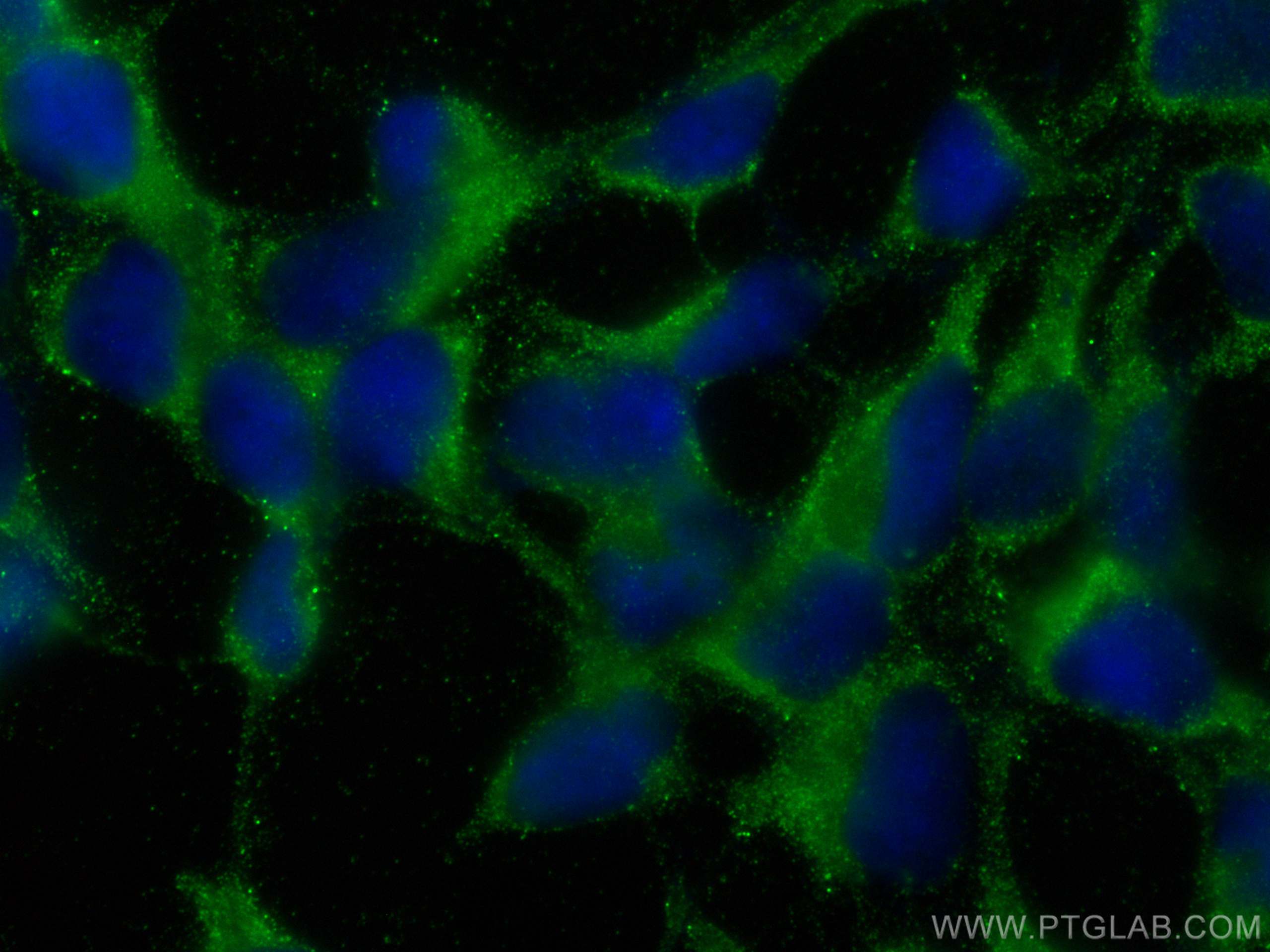 Immunofluorescence (IF) / fluorescent staining of HEK-293 cells using Maspin Monoclonal antibody (67633-1-Ig)