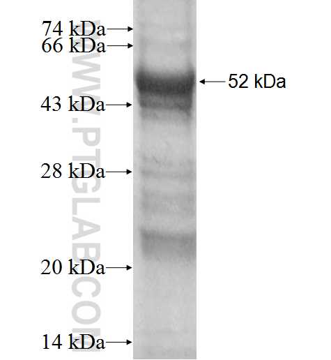 SERPINB5 fusion protein Ag2304 SDS-PAGE