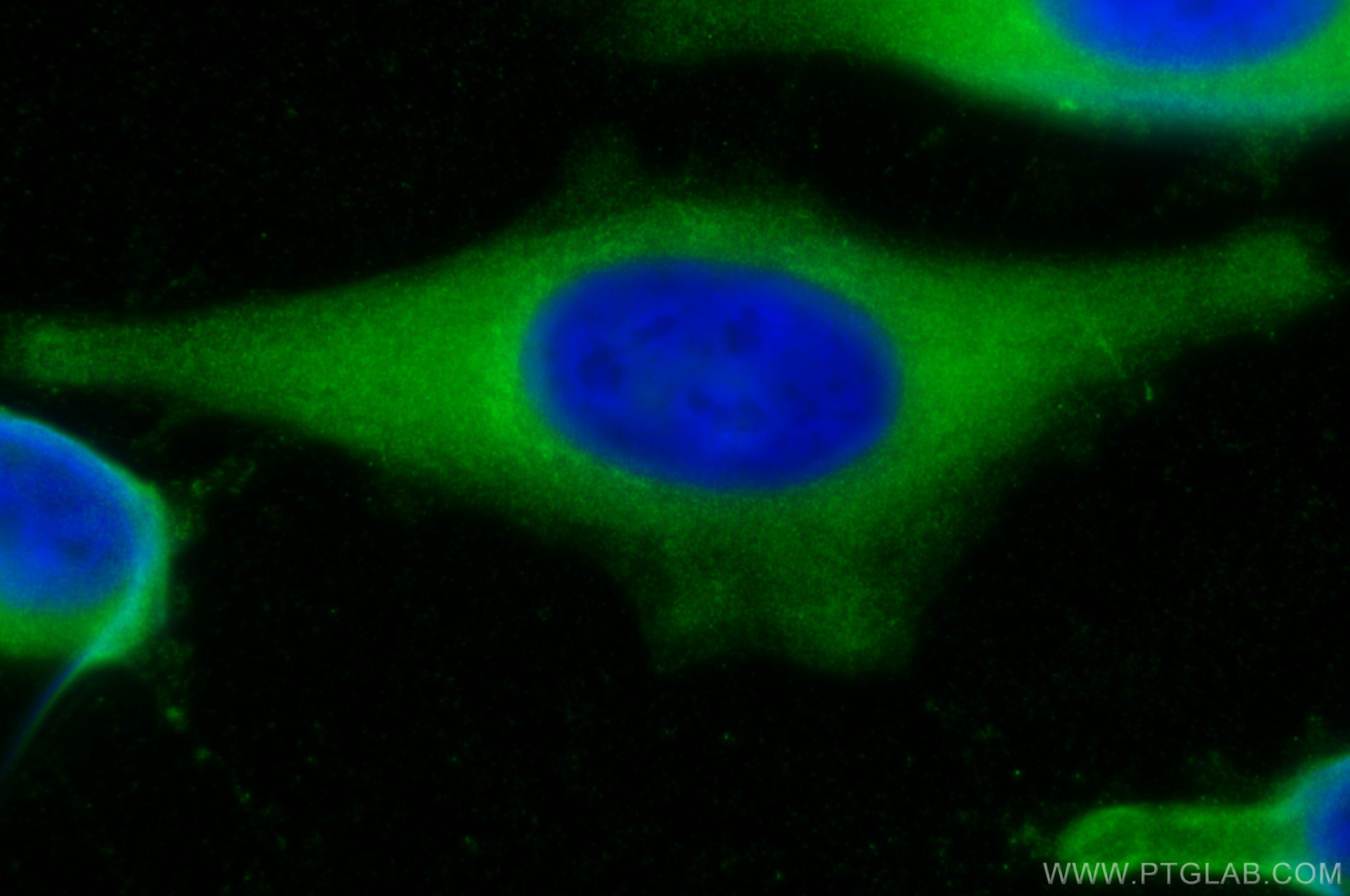 Immunofluorescence (IF) / fluorescent staining of HeLa cells using SERPINB6 Polyclonal antibody (14962-1-AP)