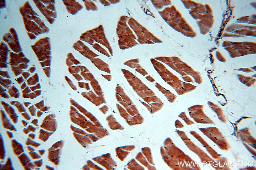 IHC staining of human skeletal muscle using 14962-1-AP