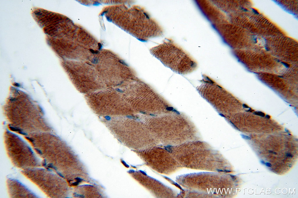 Immunohistochemistry (IHC) staining of human skeletal muscle tissue using SERPINB6 Polyclonal antibody (14962-1-AP)