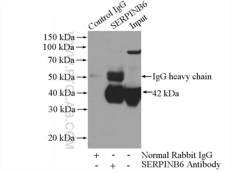 Immunoprecipitation (IP) experiment of human placenta tissue using SERPINB6 Polyclonal antibody (14962-1-AP)
