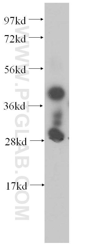 Western Blot (WB) analysis of human placenta tissue using SERPINB6 Polyclonal antibody (14962-1-AP)