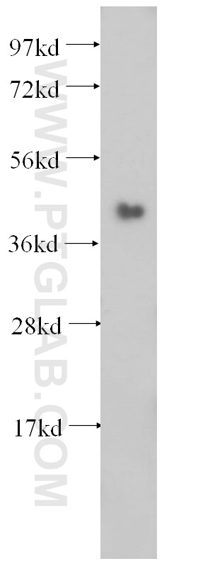 WB analysis of mouse skeletal muscle using 14962-1-AP