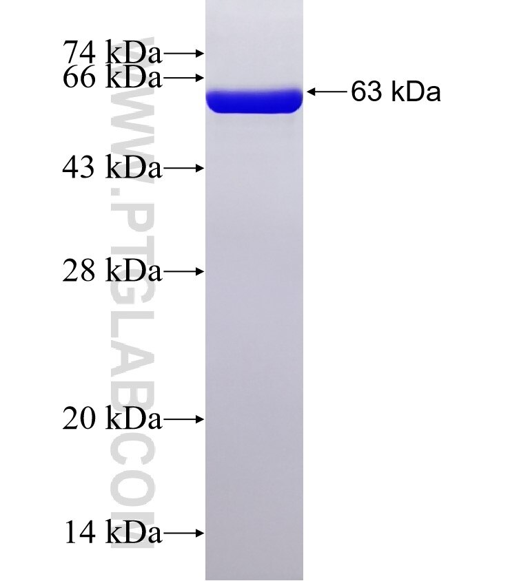 SERPINB6 fusion protein Ag6824 SDS-PAGE