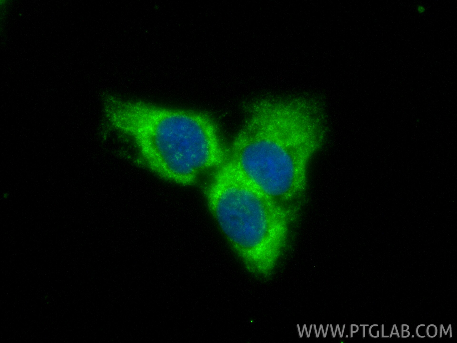 Immunofluorescence (IF) / fluorescent staining of HaCaT cells using SERPINB7 Polyclonal antibody (21170-1-AP)