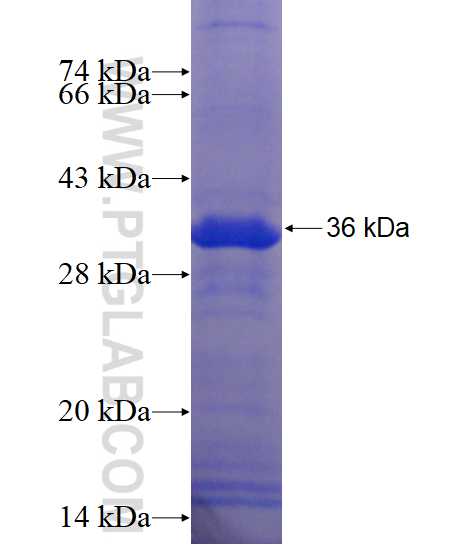 SERPINB7 fusion protein Ag15394 SDS-PAGE