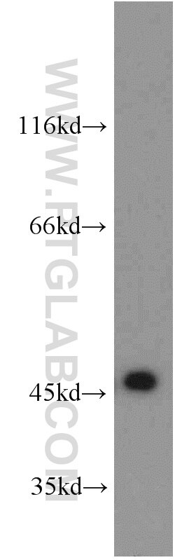 WB analysis of Jurkat using 13102-2-AP