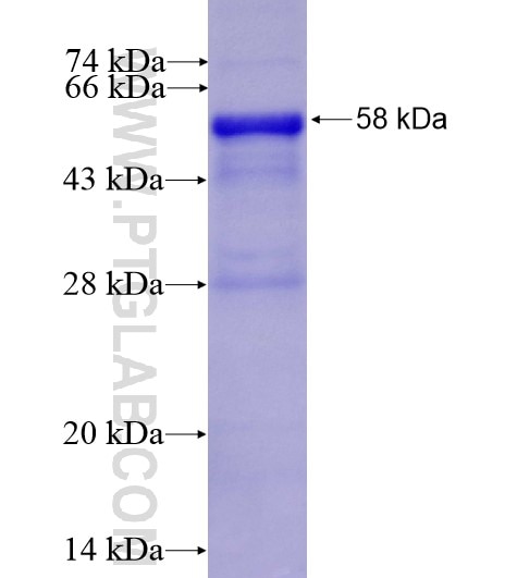 SERPINB8 fusion protein Ag3740 SDS-PAGE