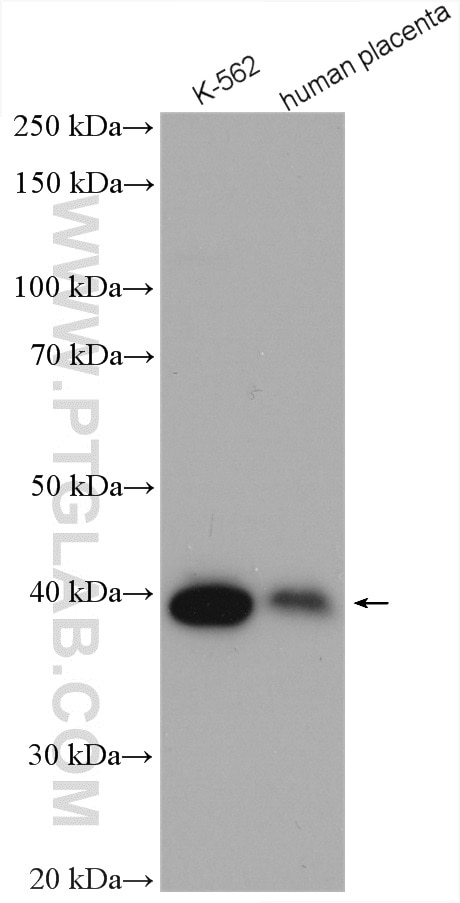Western Blot (WB) analysis of various lysates using SERPINB9 Polyclonal antibody (14910-1-AP)