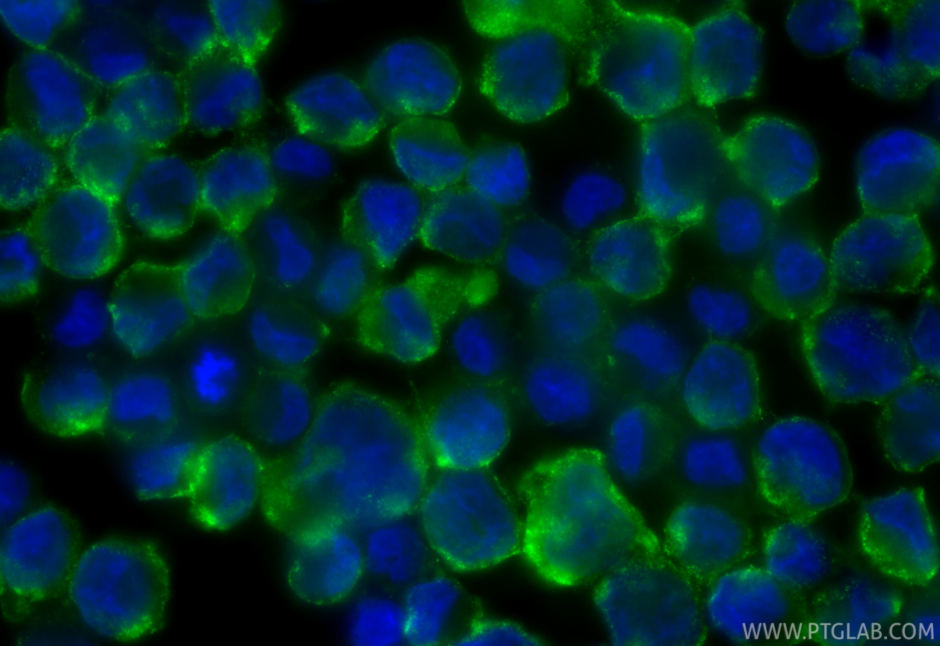 Immunofluorescence (IF) / fluorescent staining of K-562 cells using SERPINB9 Monoclonal antibody (67950-1-Ig)
