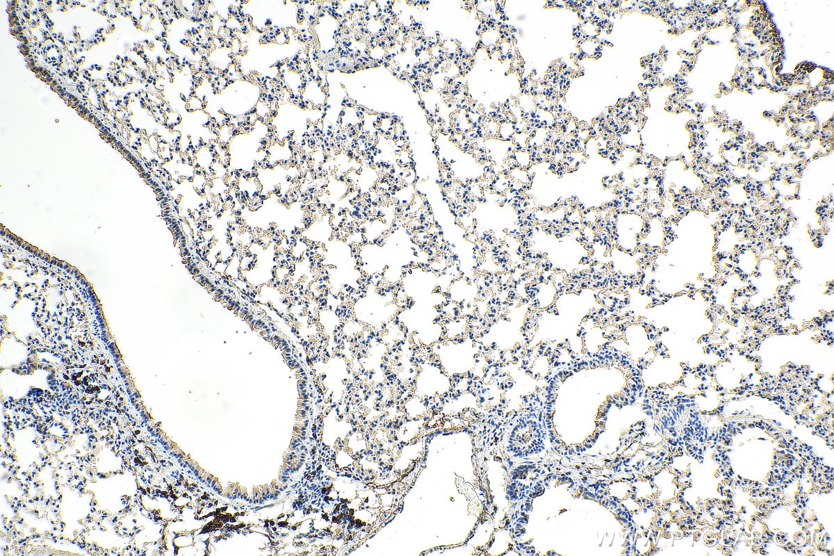 Immunohistochemistry (IHC) staining of mouse lung tissue using SERPINB9 Monoclonal antibody (67950-1-Ig)