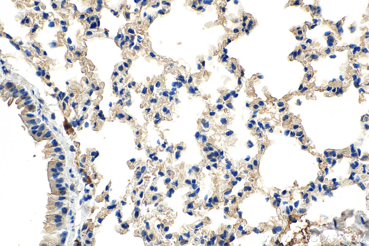 Immunohistochemistry (IHC) staining of mouse lung tissue using SERPINB9 Monoclonal antibody (67950-1-Ig)
