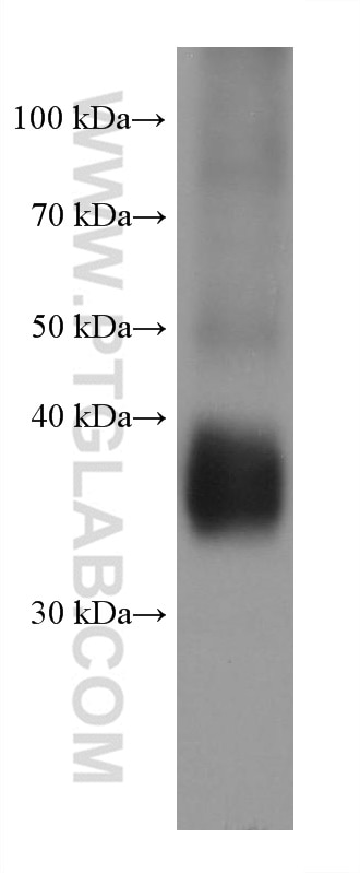Western Blot (WB) analysis of Daudi cells using SERPINB9 Monoclonal antibody (67950-1-Ig)