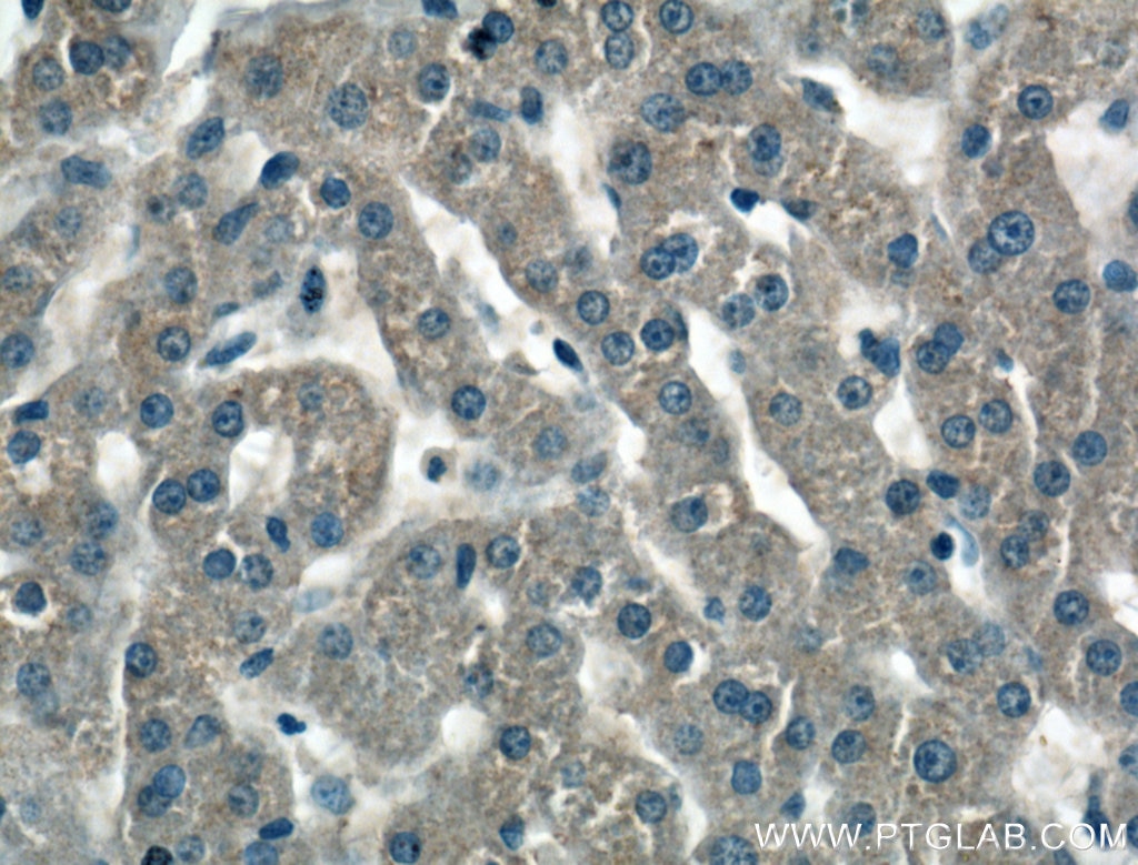 IHC staining of human liver using 16414-1-AP