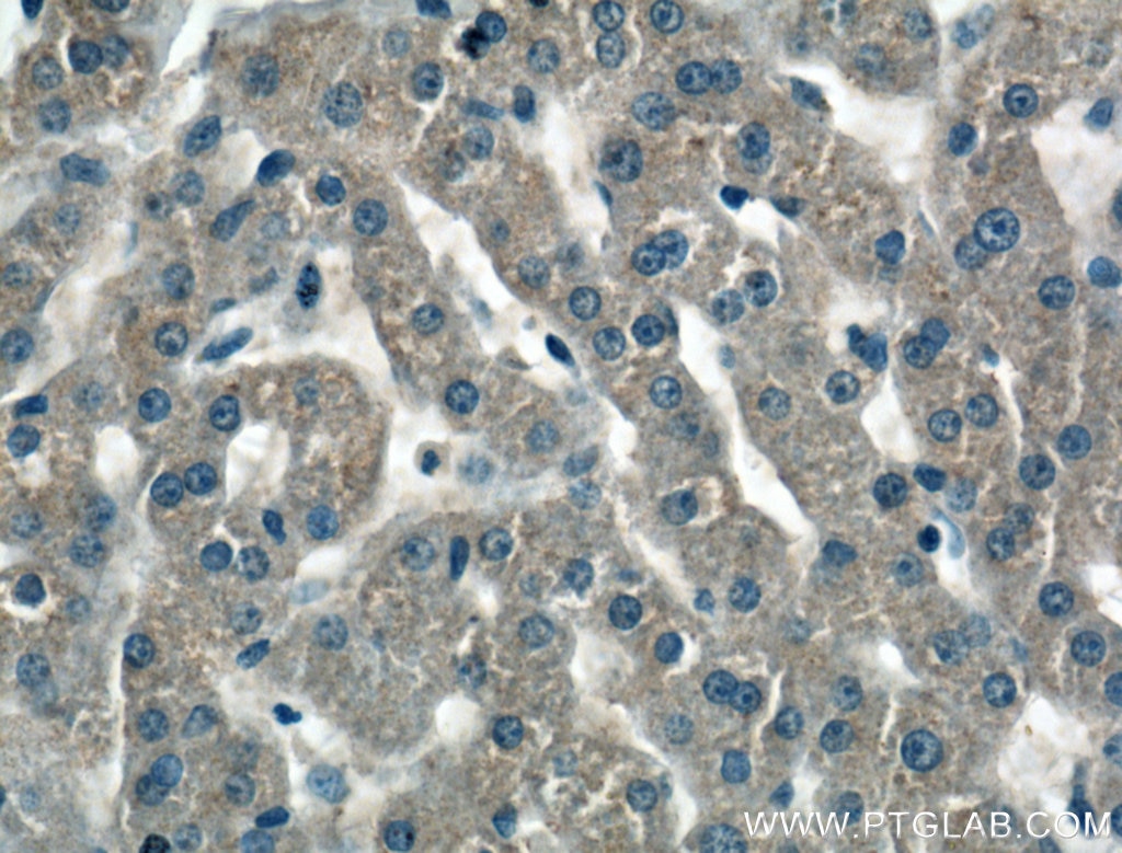 Immunohistochemistry (IHC) staining of human liver tissue using Serpin C1/Antithrombin III Polyclonal antibody (16414-1-AP)