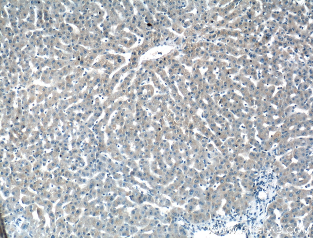Immunohistochemistry (IHC) staining of human liver tissue using Serpin C1/Antithrombin III Polyclonal antibody (16414-1-AP)