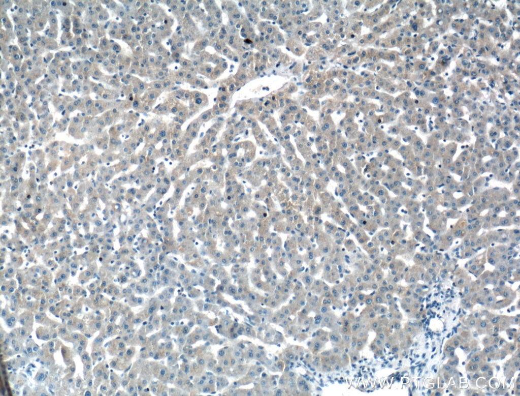 IHC staining of human liver using 16414-1-AP