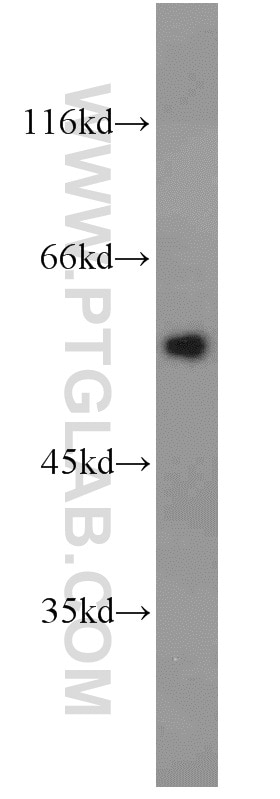 Western Blot (WB) analysis of human plasma using Serpin C1/Antithrombin III Polyclonal antibody (16414-1-AP)