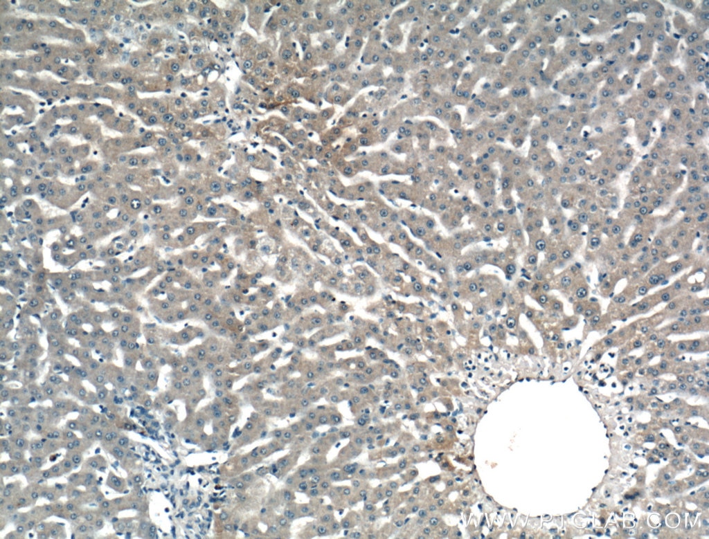 IHC staining of human liver using 66052-1-Ig