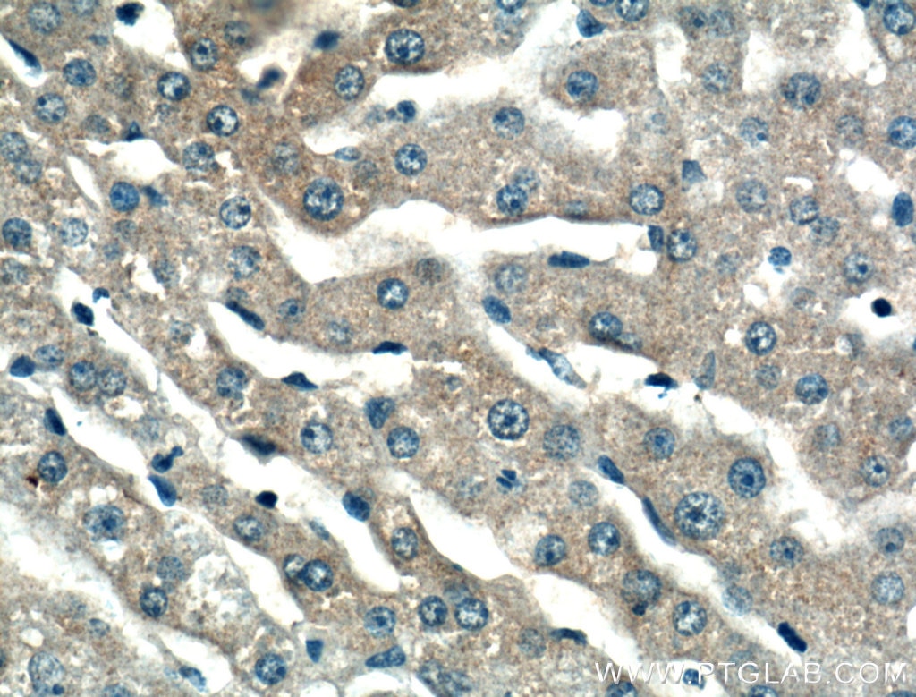 Immunohistochemistry (IHC) staining of human liver tissue using Serpin C1/Antithrombin III Monoclonal antibody (66052-1-Ig)