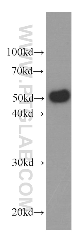 Western Blot (WB) analysis of rat brain tissue using Serpin C1/Antithrombin III Monoclonal antibody (66052-1-Ig)