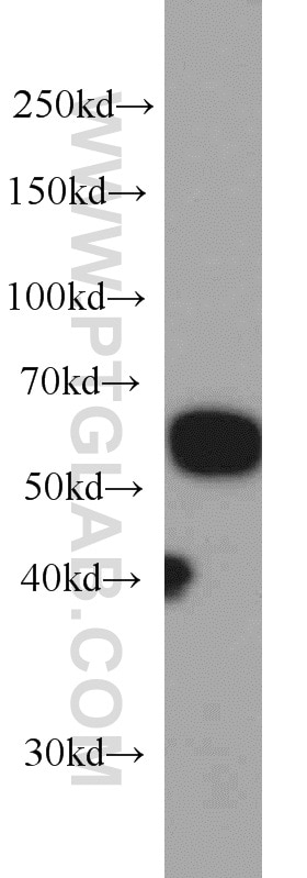 Serpin C1/Antithrombin III