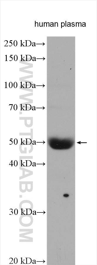 Western Blot (WB) analysis of various lysates using SERPIND1 Polyclonal antibody (12741-1-AP)