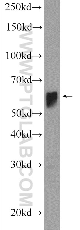Western Blot (WB) analysis of human plasma using SERPIND1 Polyclonal antibody (12741-1-AP)
