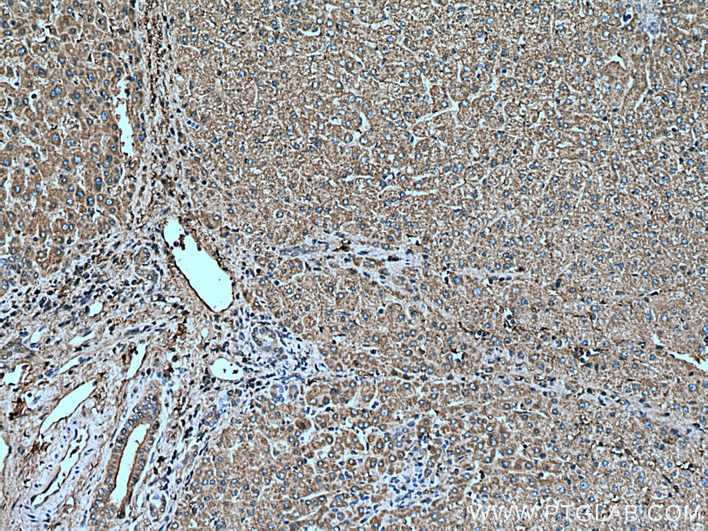 Immunohistochemistry (IHC) staining of human liver tissue using SERPIND1 Monoclonal antibody (67602-1-Ig)