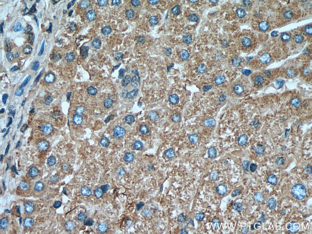 Immunohistochemistry (IHC) staining of human liver tissue using SERPIND1 Monoclonal antibody (67602-1-Ig)