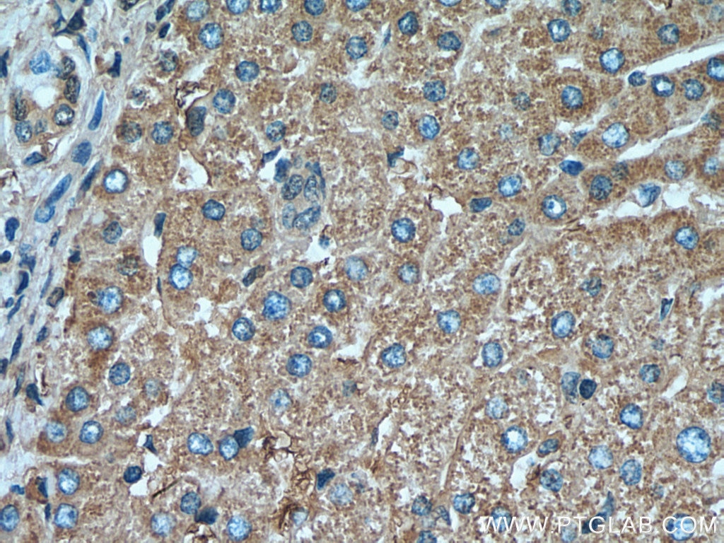 Immunohistochemistry (IHC) staining of human liver tissue using SERPIND1 Monoclonal antibody (67602-1-Ig)
