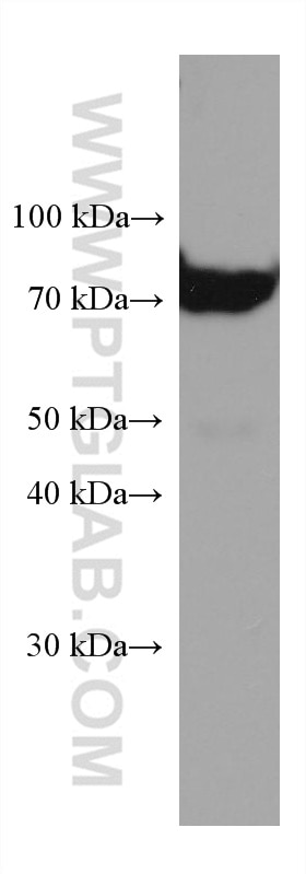 Western Blot (WB) analysis of pig plasma using SERPIND1 Monoclonal antibody (67602-1-Ig)