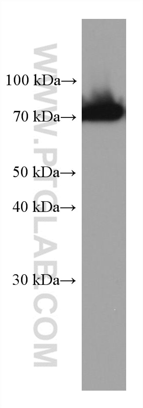 Western Blot (WB) analysis of human plasma using SERPIND1 Monoclonal antibody (67602-1-Ig)